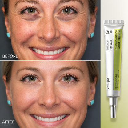 Retinal Shot™ Tightening Booster
